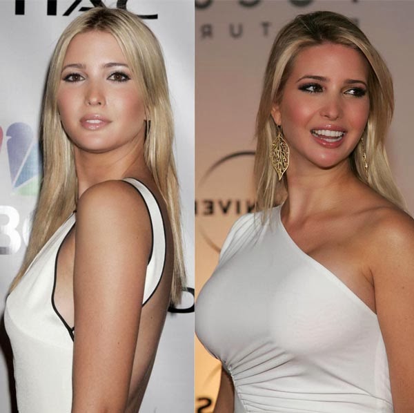 Celebrity Boob Jobs Before And After