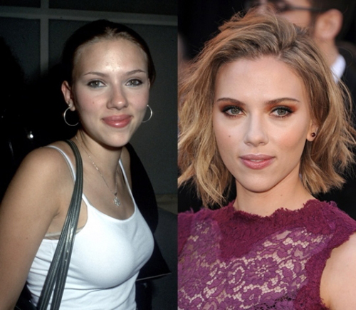 15 Celebrities You Didn T Realise Have Had Plastic Surgery Collegetimes Com