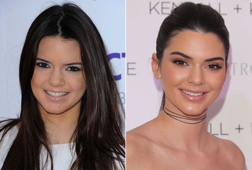 15 Celebrities You Didn T Realise Have Had Plastic Surgery Collegetimes Com