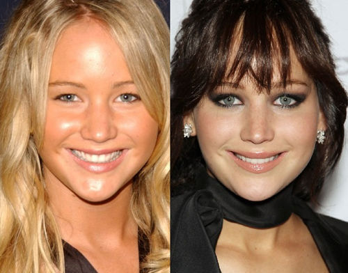 15 Celebrities You Didn T Realise Have Had Plastic Surgery Collegetimes Com